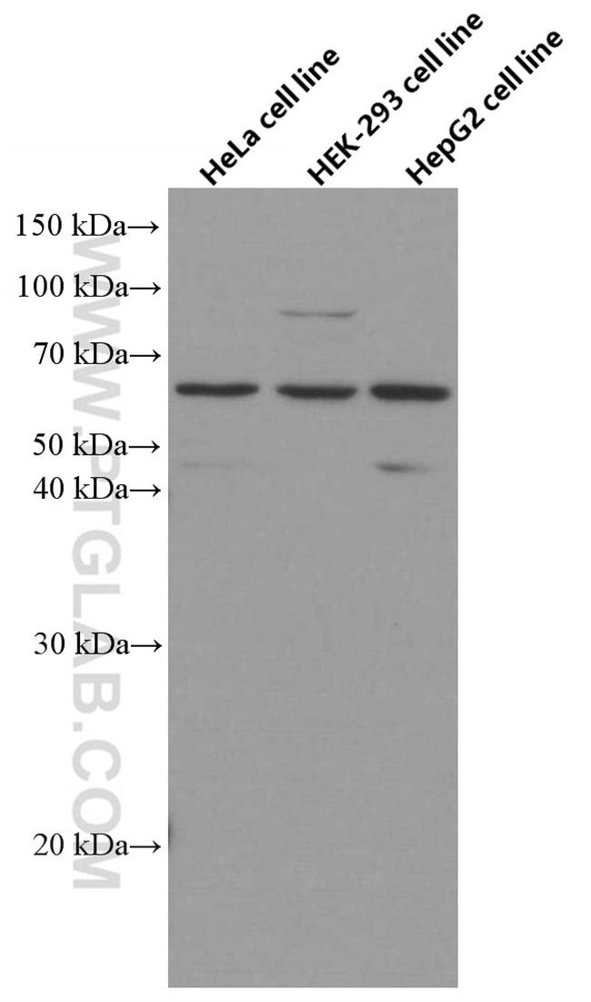 AGXT2 Antibody in Western Blot (WB)