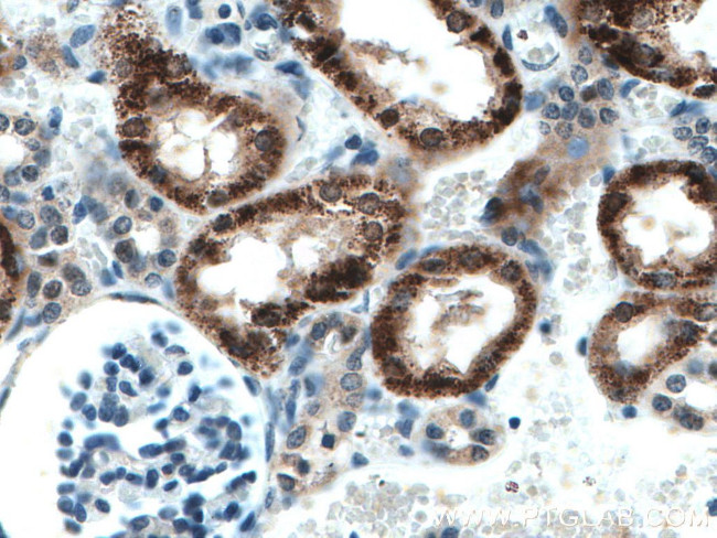 AGXT2 Antibody in Immunohistochemistry (Paraffin) (IHC (P))