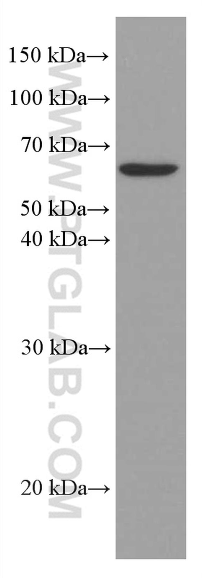 AGXT2 Antibody in Western Blot (WB)