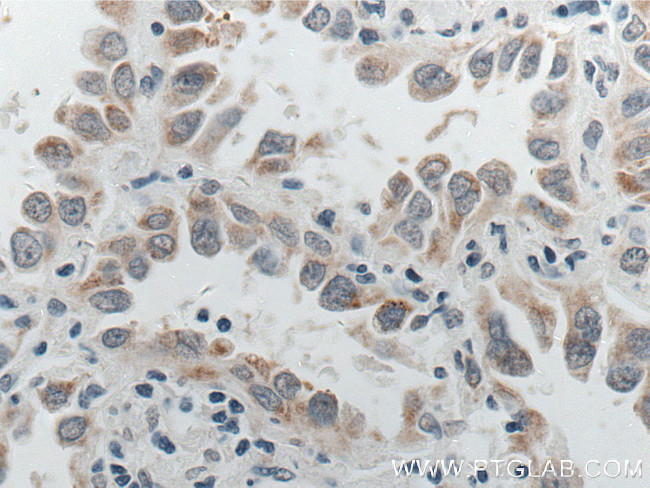 P4HA2 Antibody in Immunohistochemistry (Paraffin) (IHC (P))