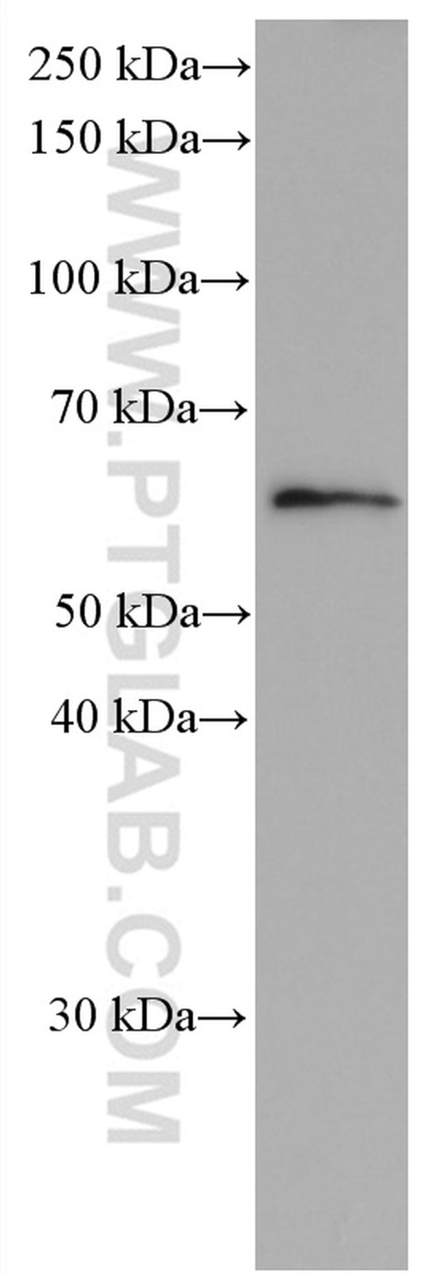 P4HA2 Antibody in Western Blot (WB)