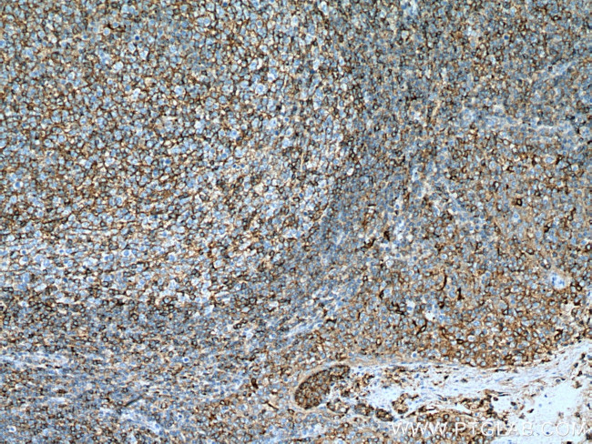 FYN Antibody in Immunohistochemistry (Paraffin) (IHC (P))