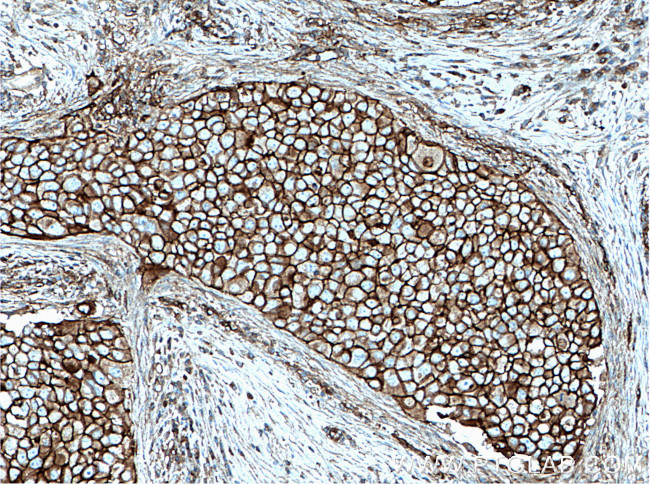 FYN Antibody in Immunohistochemistry (Paraffin) (IHC (P))