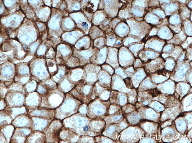 FYN Antibody in Immunohistochemistry (Paraffin) (IHC (P))