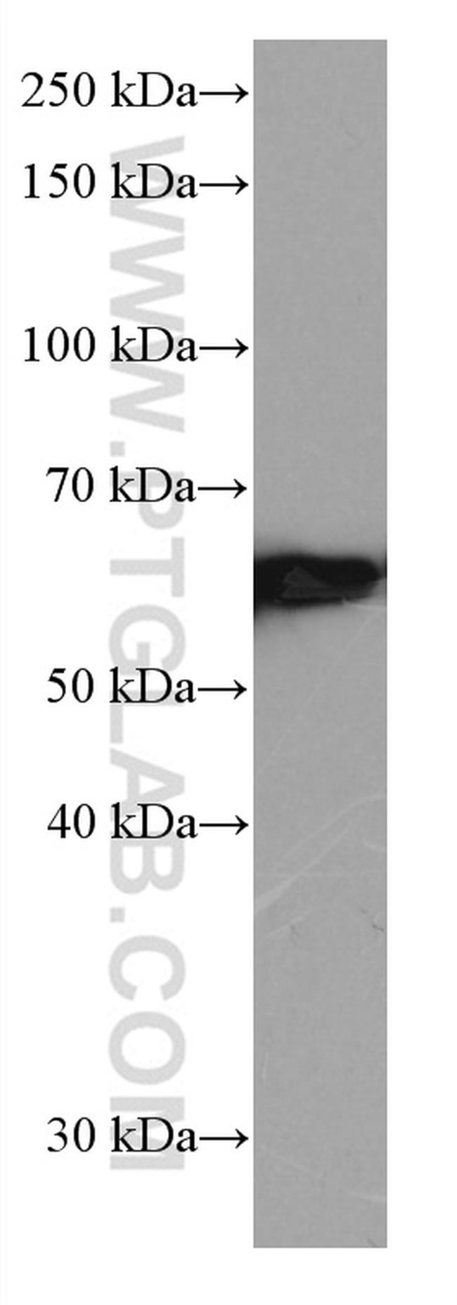 FYN Antibody in Western Blot (WB)