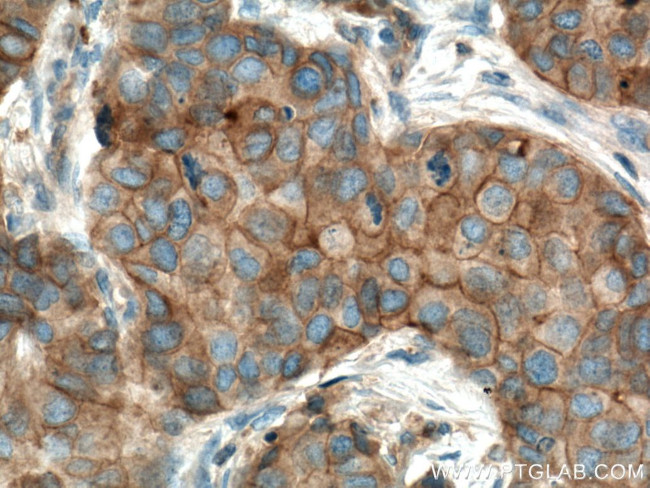 FYN Antibody in Immunohistochemistry (Paraffin) (IHC (P))