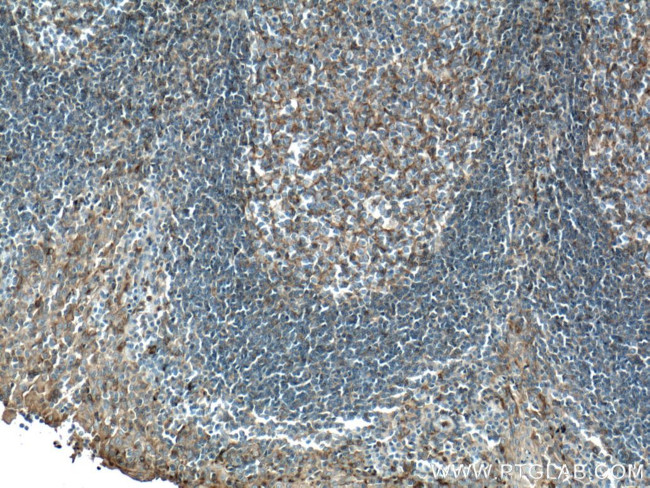 FYN Antibody in Immunohistochemistry (Paraffin) (IHC (P))