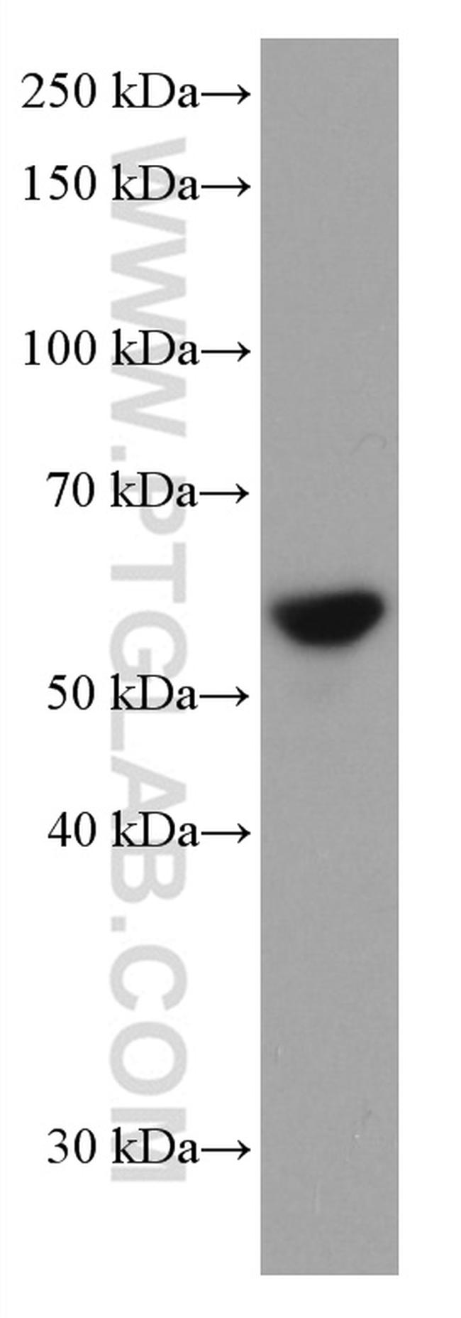 FYN Antibody in Western Blot (WB)