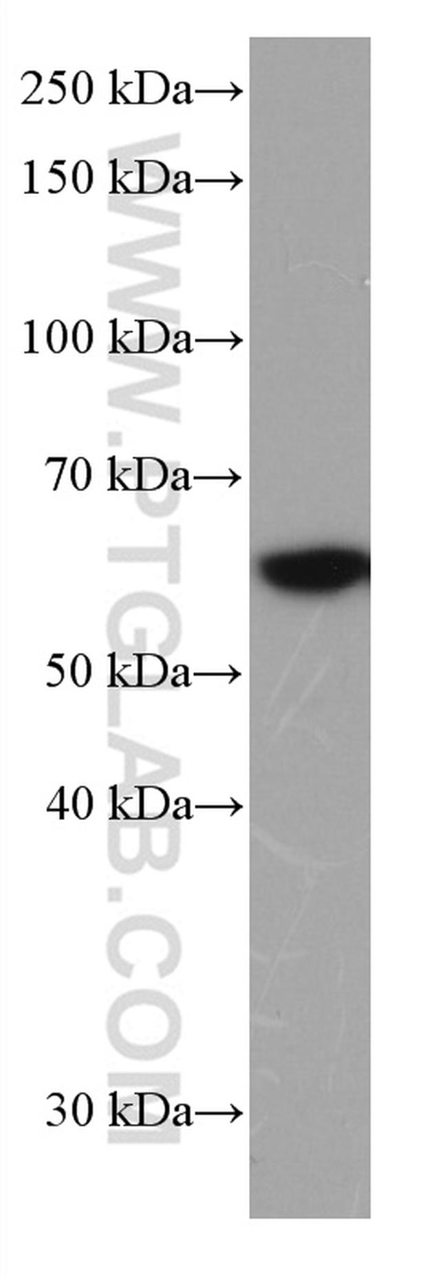 FYN Antibody in Western Blot (WB)