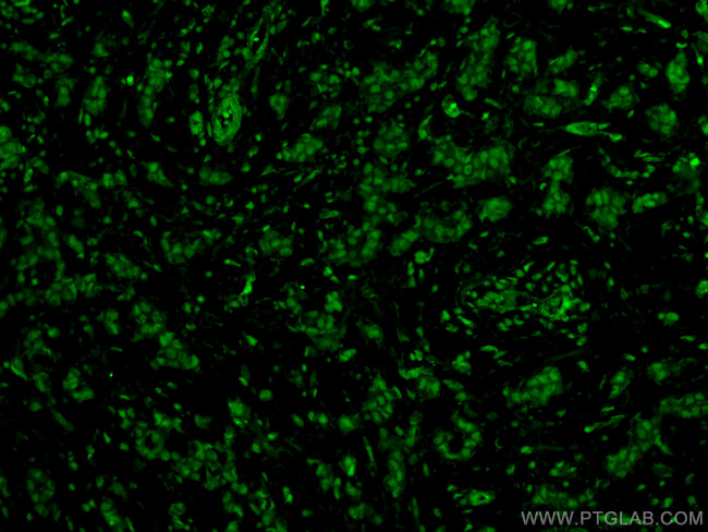 KU70/XRCC6 Antibody in Immunohistochemistry (PFA fixed) (IHC (PFA))