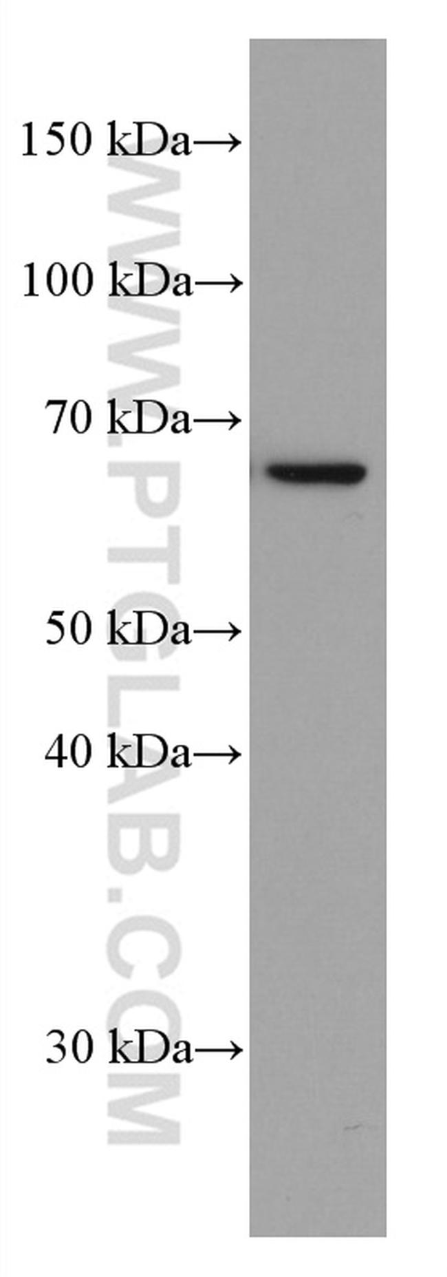 KU70/XRCC6 Antibody in Western Blot (WB)