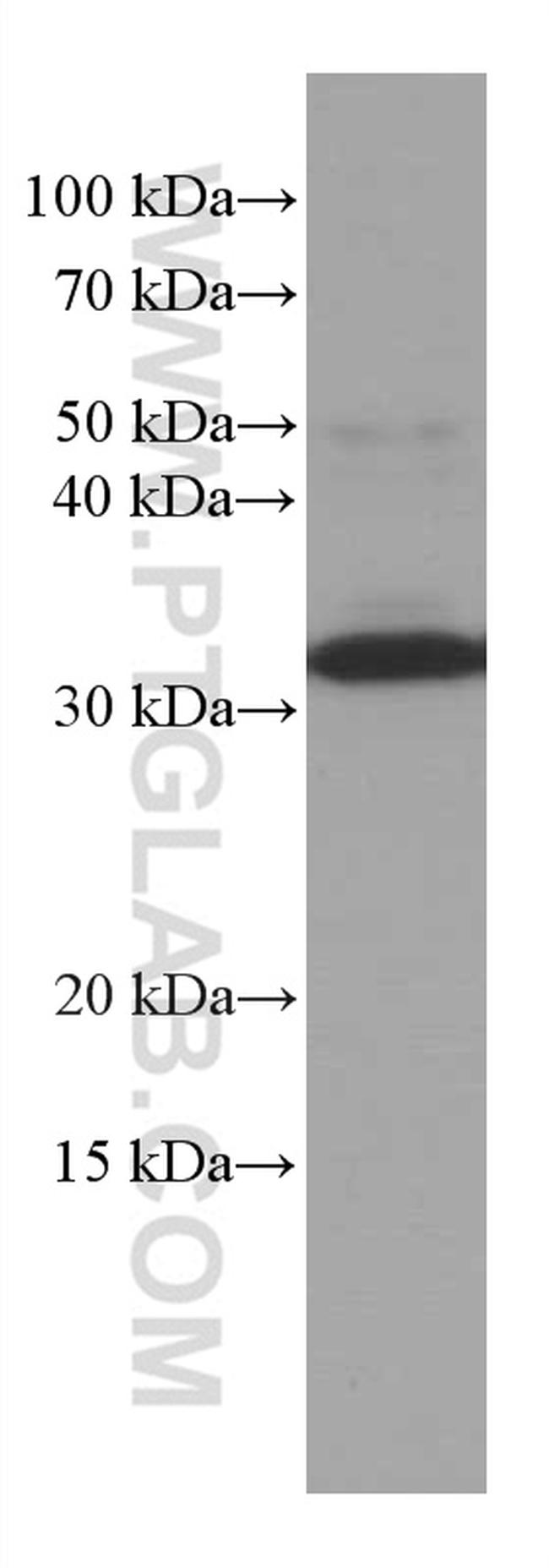 MMACHC Antibody in Western Blot (WB)