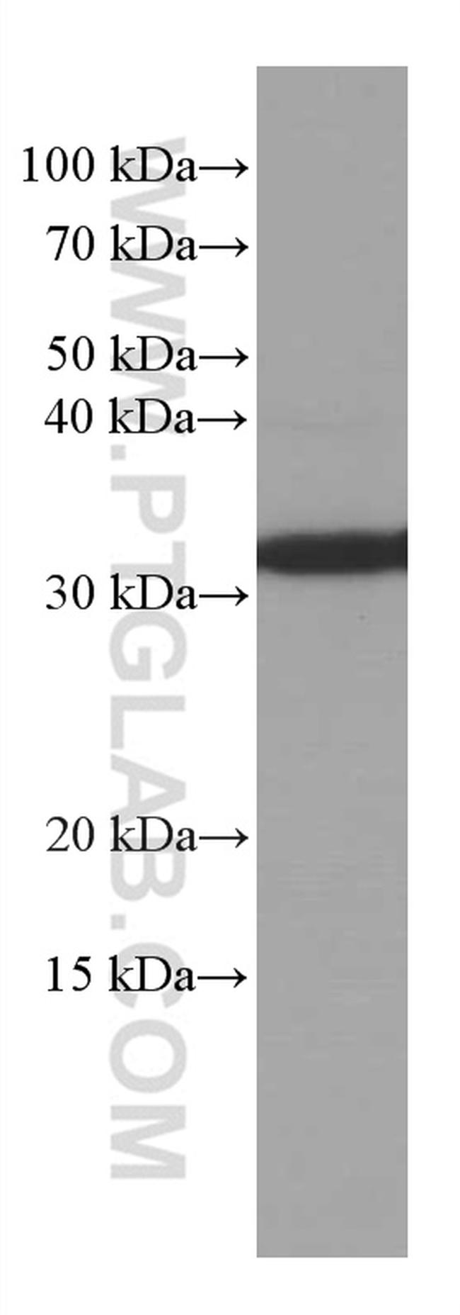 MMACHC Antibody in Western Blot (WB)