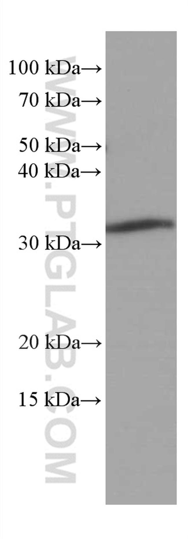 MMACHC Antibody in Western Blot (WB)