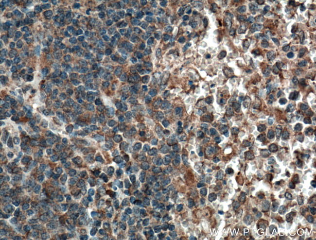 CCRL2 Antibody in Immunohistochemistry (Paraffin) (IHC (P))