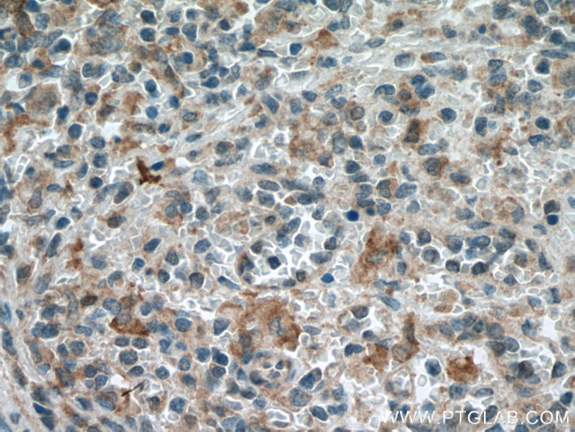 MTHFR Antibody in Immunohistochemistry (Paraffin) (IHC (P))