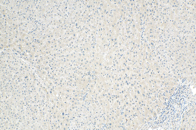 MTHFR Antibody in Immunohistochemistry (Paraffin) (IHC (P))