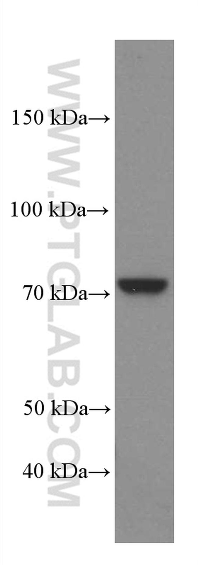 MTHFR Antibody in Western Blot (WB)