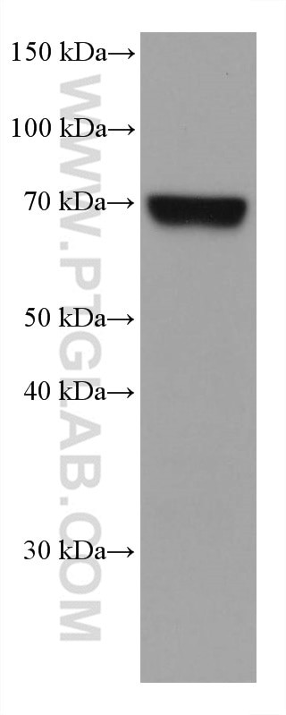 MTHFR Antibody in Western Blot (WB)