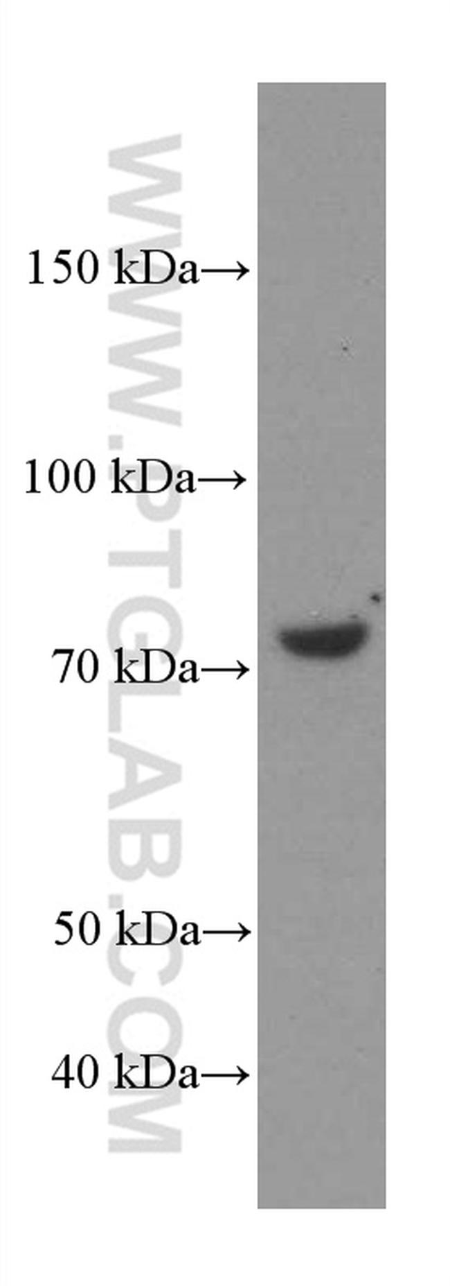 MTHFR Antibody in Western Blot (WB)