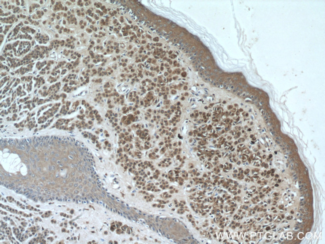 S100 beta Antibody in Immunohistochemistry (Paraffin) (IHC (P))