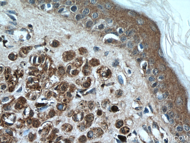 S100 beta Antibody in Immunohistochemistry (Paraffin) (IHC (P))