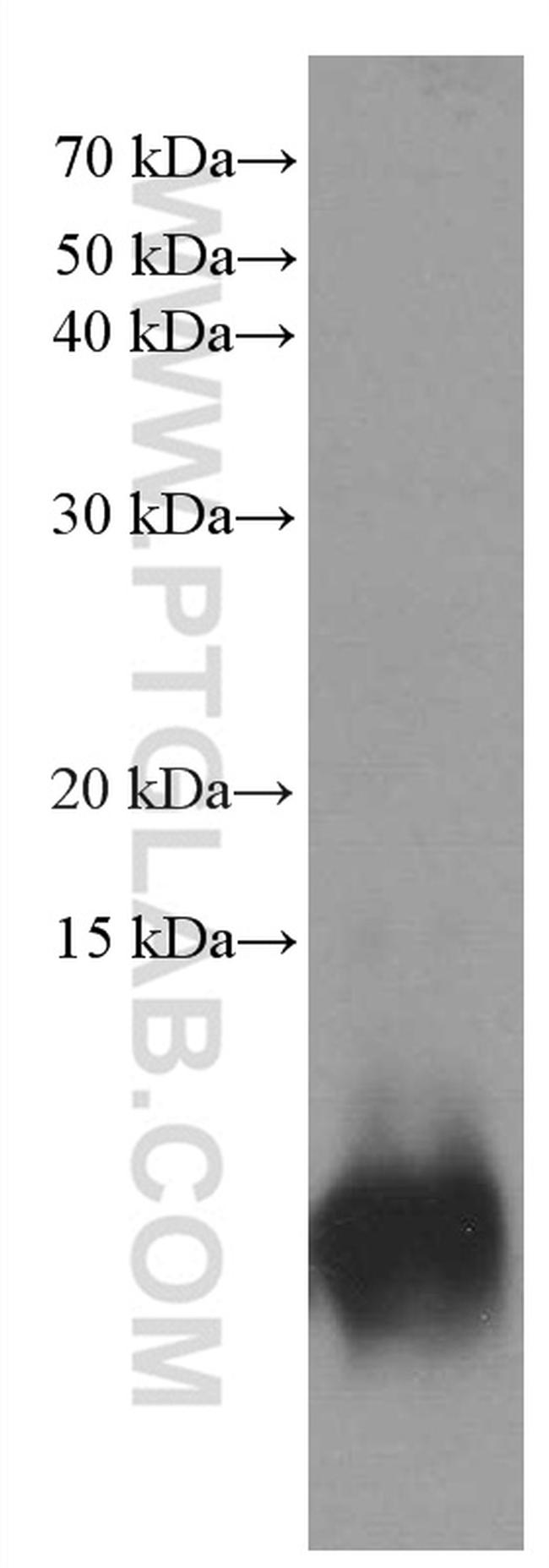 S100 beta Antibody in Western Blot (WB)