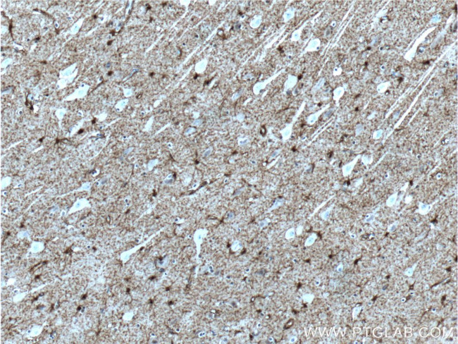 S100 beta Antibody in Immunohistochemistry (Paraffin) (IHC (P))