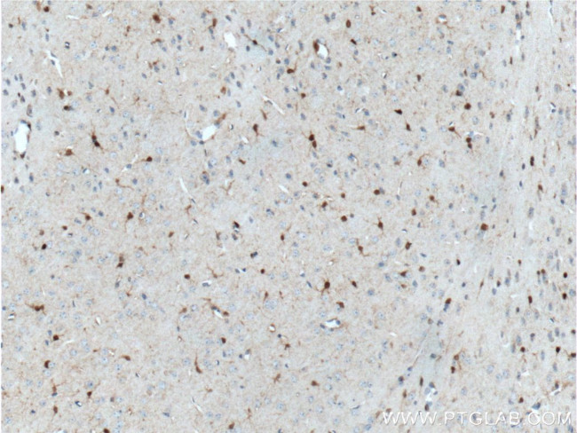 S100 beta Antibody in Immunohistochemistry (Paraffin) (IHC (P))