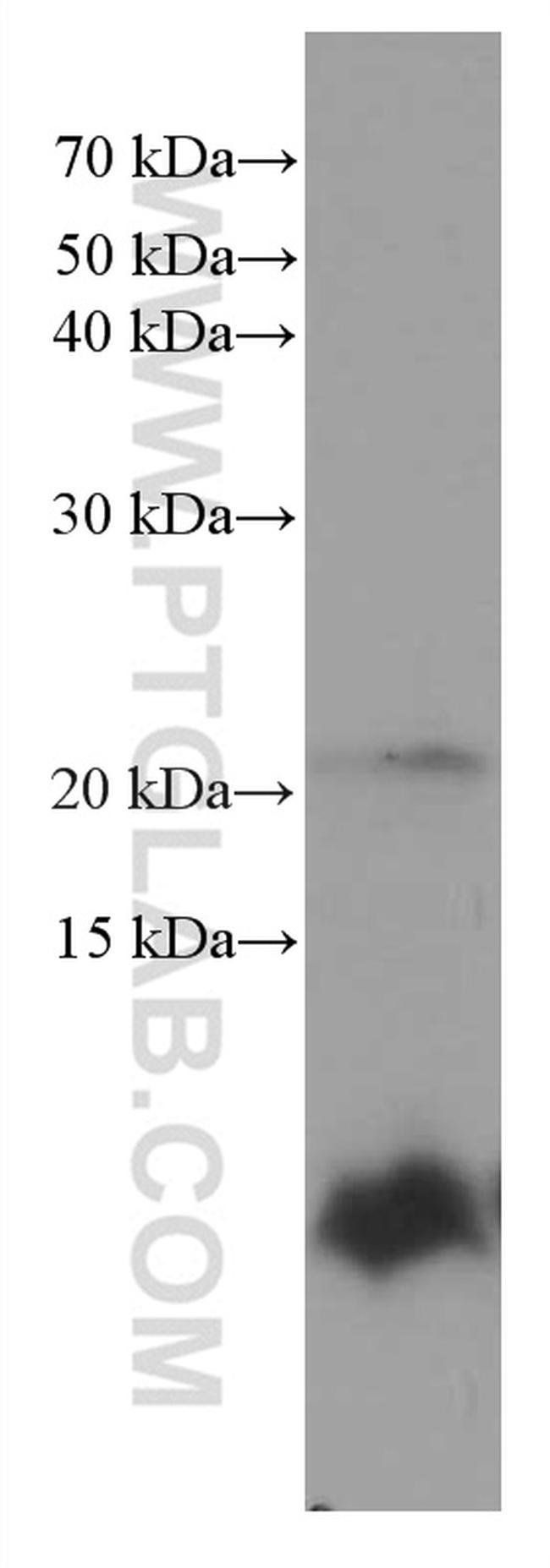 S100 beta Antibody in Western Blot (WB)