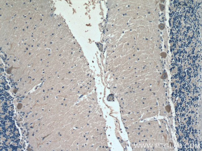 ACSL4 Antibody in Immunohistochemistry (Paraffin) (IHC (P))