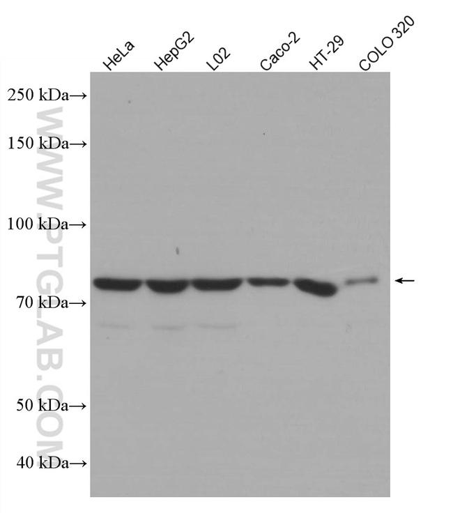 ACSL4 Antibody in Western Blot (WB)