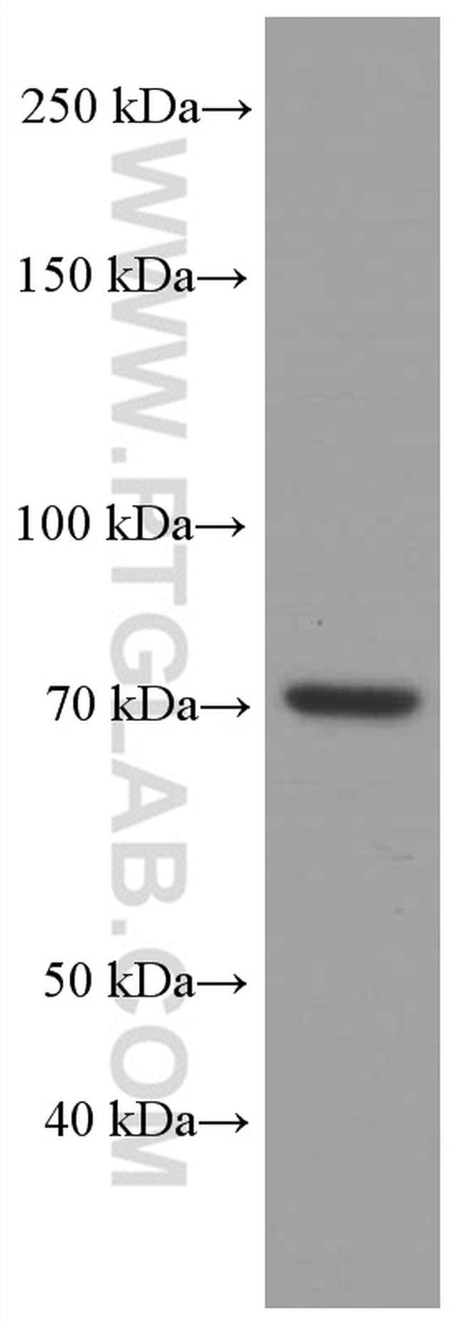 ACSL4 Antibody in Western Blot (WB)