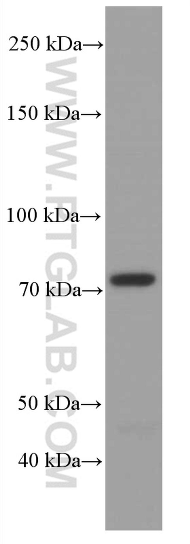 ACSL4 Antibody in Western Blot (WB)