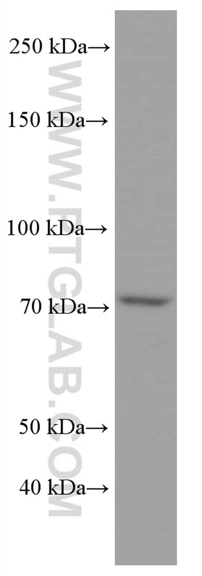 ACSL4 Antibody in Western Blot (WB)