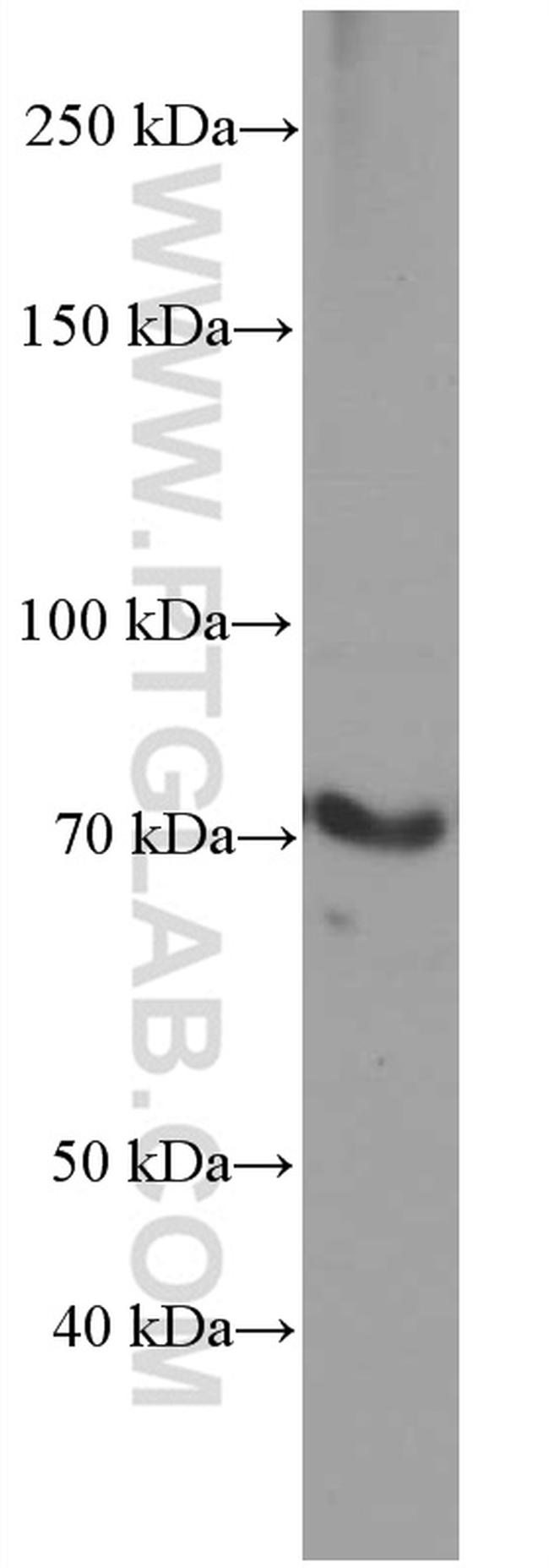 ACSL4 Antibody in Western Blot (WB)