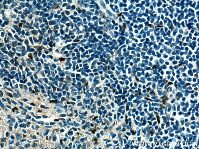 SPI1 Antibody in Immunohistochemistry (Paraffin) (IHC (P))