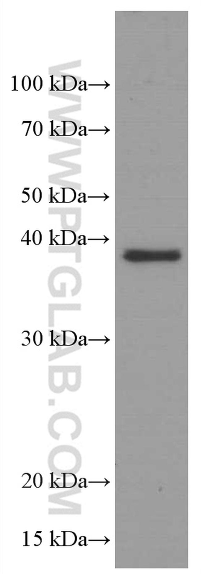 SPI1 Antibody in Western Blot (WB)