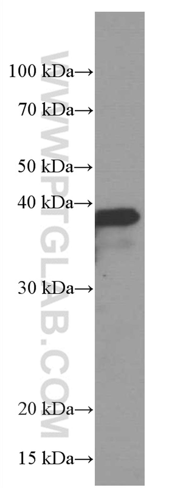 SPI1 Antibody in Western Blot (WB)