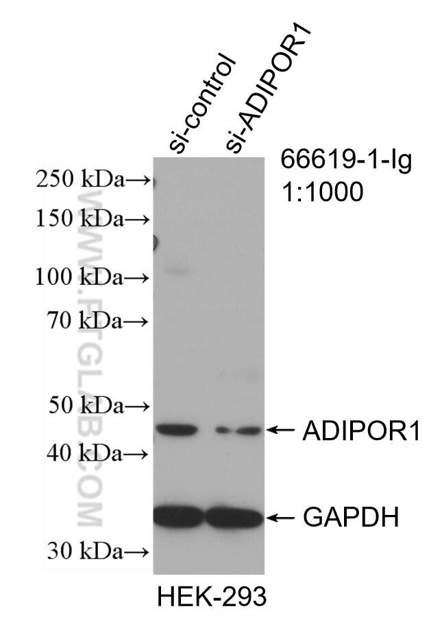 Adiponectin receptor 1 Antibody in Western Blot (WB)