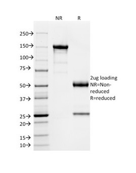 SOX9/SRY-box 9 Antibody in SDS-PAGE (SDS-PAGE)