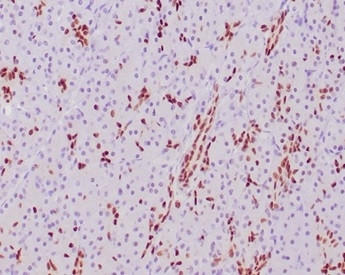 SOX9/SRY-box 9 Antibody in Immunohistochemistry (Paraffin) (IHC (P))