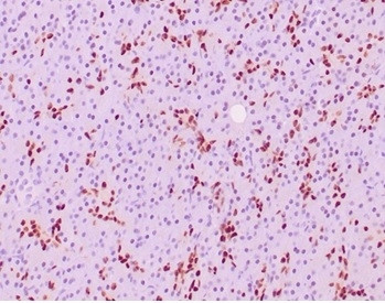 SOX9/SRY-box 9 Antibody in Immunohistochemistry (Paraffin) (IHC (P))