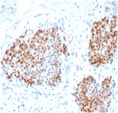 SOX9/SRY-box 9 Antibody in Immunohistochemistry (Paraffin) (IHC (P))