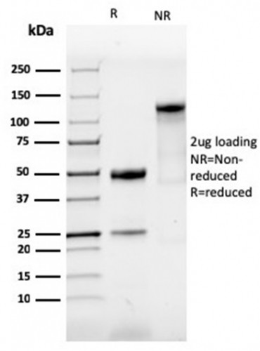 SOX9/SRY-box 9 Antibody in SDS-PAGE (SDS-PAGE)