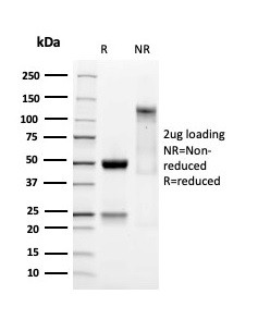 SOX9/SRY-box 9 Antibody in SDS-PAGE (SDS-PAGE)