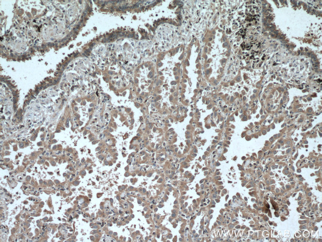 ADAM10 Antibody in Immunohistochemistry (Paraffin) (IHC (P))