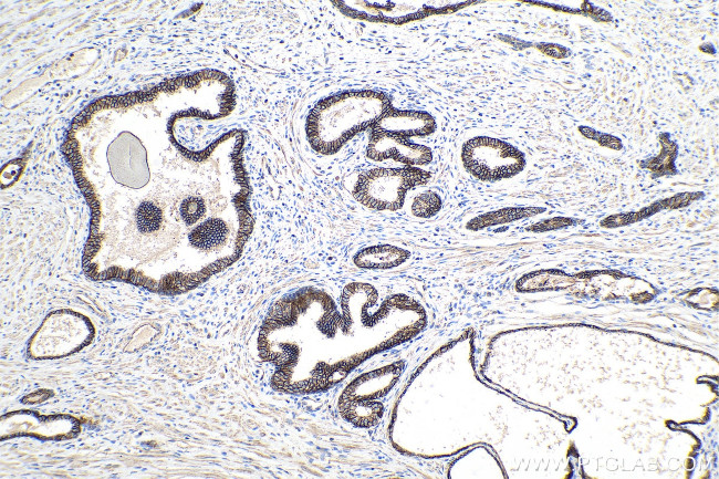 ADAM10 Antibody in Immunohistochemistry (Paraffin) (IHC (P))