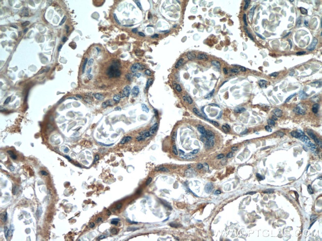 ADAM10 Antibody in Immunohistochemistry (Paraffin) (IHC (P))