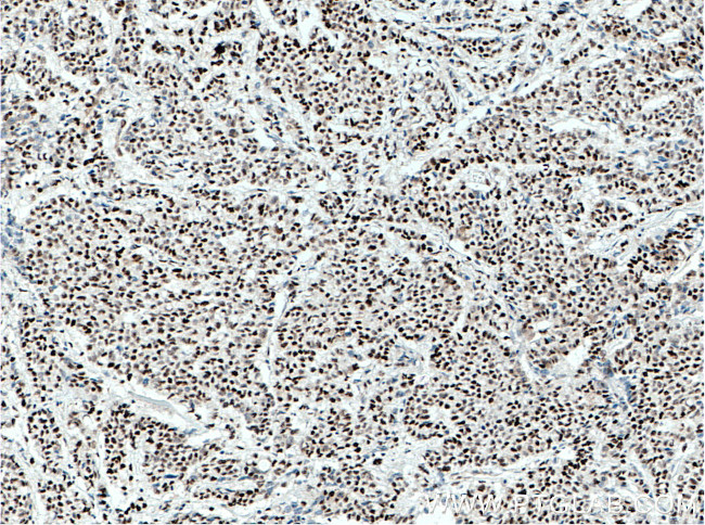 XRCC4 Antibody in Immunohistochemistry (Paraffin) (IHC (P))